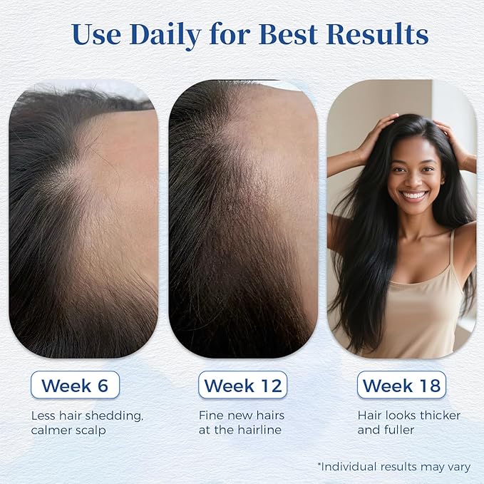 Hair Growth Serum Roll On with Rosemary，Helps Support Thicker, Fuller Hair Appearance，Clean, Non-Greasy Hair Loss Support for Men & Women，Saw Palmetto，0.84 Fl Oz (Pack of 3)
