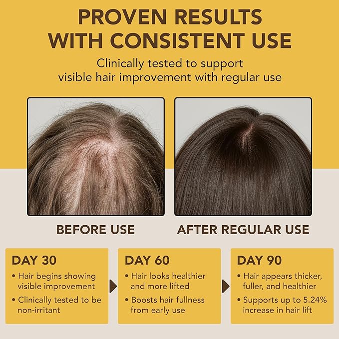 Botanic Hearth Hair Oil for Hair Growth & Hair Treatment Oils | Strengthening Dry, Frizzy, Damaged Hair & Scalp Treatment | Batana Oil – 2 Fl Oz