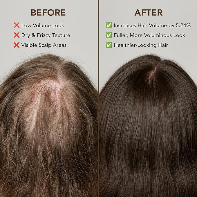 Botanic Hearth Hair Oil for Hair Growth & Hair Treatment Oils | Strengthening Dry, Frizzy, Damaged Hair & Scalp Treatment | Batana Oil – 2 Fl Oz