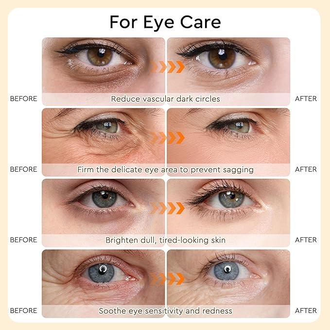 Under Eye Patches For Puffy Eyes and Dark Circles, Soothing Hydrating Eye Mask with Calendula, Green Tea, Retinol, Undereye Bags Skin Care - Mothers Day Gifts for Mom (30 Pairs)