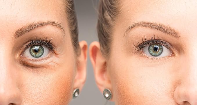 Su-Skin Anti Aging Eye Cream, Bright Eyes, Daily Wrinkle Cream for Firming, Dark Circles, Puffiness