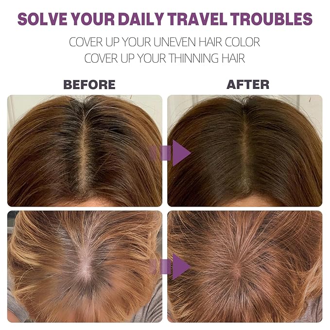 Hairline Powder Instantly Conceals Hair Loss, Root Touch Up Hair Color Powder, Hair Toppers for Women Men, Hair Fibers for Thinning Hair, Root Cover Up lasting 24 hours (Medium Brown, 0.35)