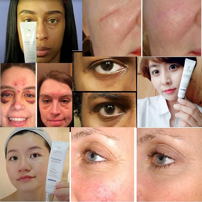 Vitamin K1 Oxiderm Cream Minimizing Appearance of Old and New Scars, Dark Eye Circles, Bruises, Varicose Veins, Redness Relieve 1.01Oz