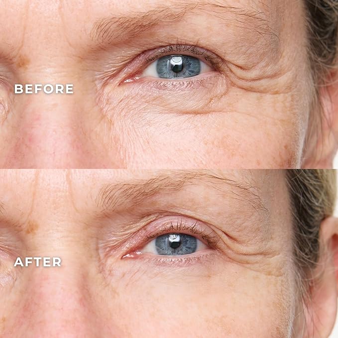 WUNDER2 Wunderlift Instant Eye Tightening Serum, Temporary Firming & Lifting Treatment in 60 Seconds, Reduces Under-Eye Bags, Dark Circles, Puffiness, Anti-aging Fine Lines