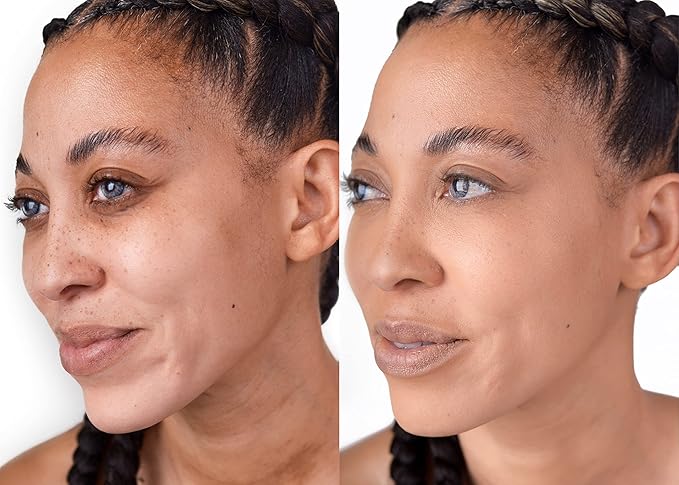 The Good Mineral Loves-You-Back 3in1 Mineral Powder Foundation (CARAMEL 1) | Designed for acne-prone, sensitive skin reducing the appearance of acne and scars without layers | Vegan + Cruelty Free