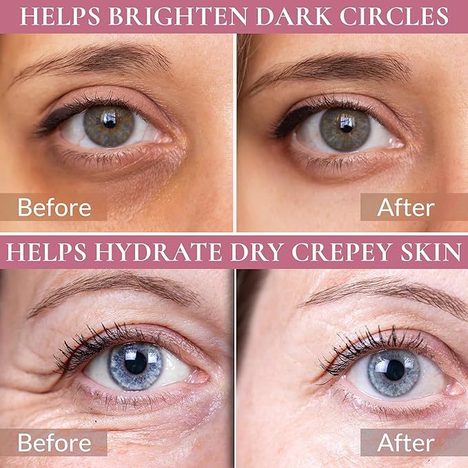 Eye Serum for Dark Circles and Puffiness, Multi Peptide and Caffeine Under Eye Treatment for Eye Bags, Wrinkles and Fine Lines, Anti Aging Firming and Tightening Formula, 0.58 Fl Oz