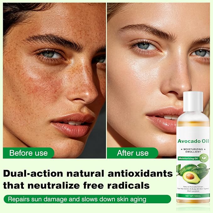 Avocado Oil for Face, Hair & Body - Natural Moisturizing Oil with Jojoba, Olive & Shea Butter - Brightens, Hydrates & Repairs Dry Skin, Damaged Hair - All Skin Types, 3.38 fl oz