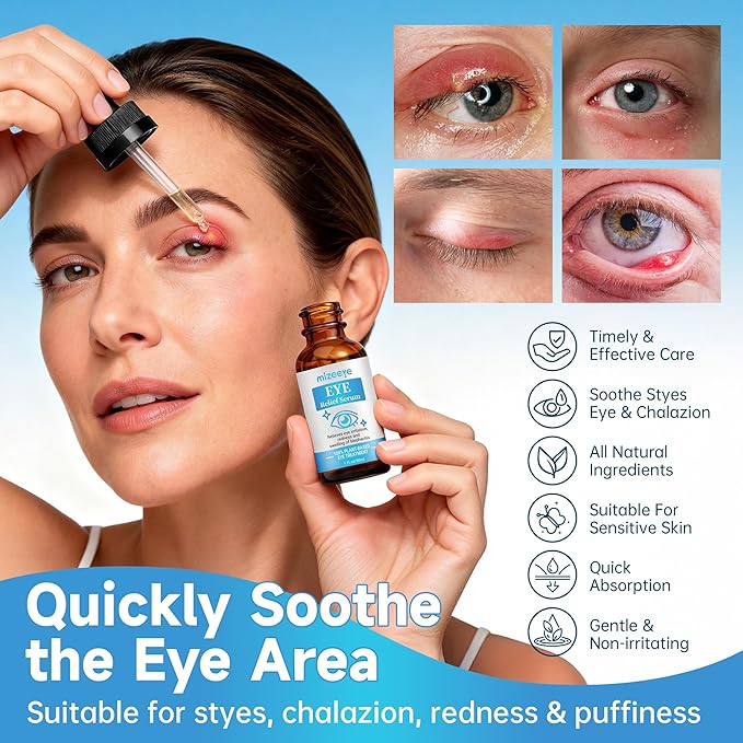 Eye Serum For Chalazion & Blepharitis, 30ML Chalazion Remover For Eyelid, Blepharitis Eyelid Serum With Avocado Oil, Sea Buckthorn Oil & Caffeine, Relieve Puffiness and Eye Fatigue