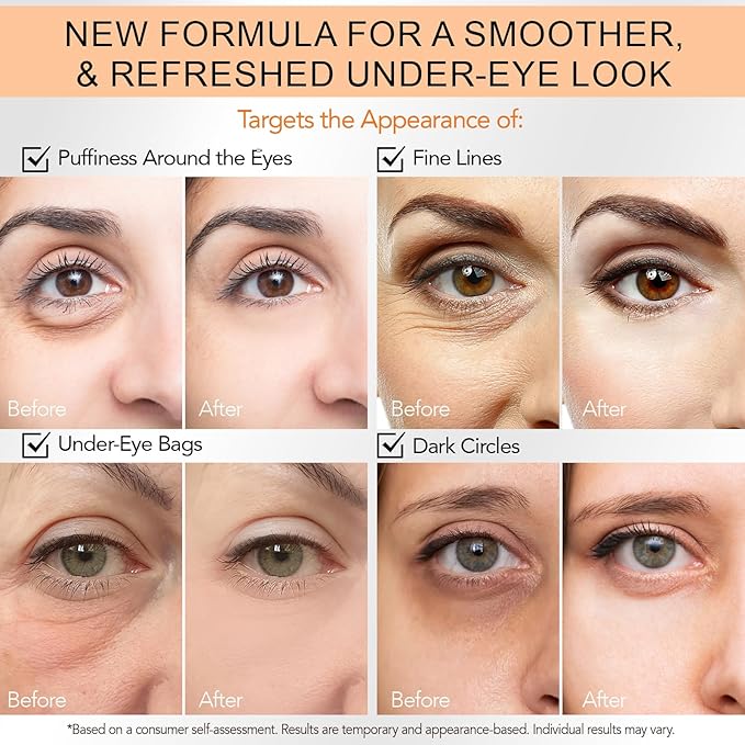 Temporary Instant Eye Tightener Cream, Temporary Eye Tightener Eye Cream, Instant Reduces Under-Eye Bags, Dark Circles&Puffiness, Anti Aging Fine Lines, Gentle Formula for All Skin Types - 1.05 Fl.Oz