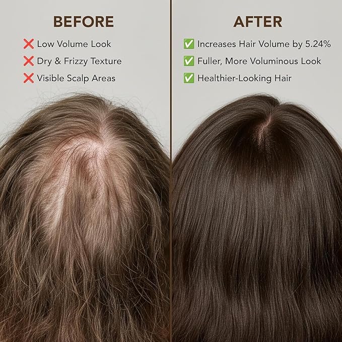 Botanic Hearth Batana Oil for Hair Growth & Hair Treatment Oils | Dr Sebi Inspired, 100% Raw & Pure Batana Oil | Scalp & Hair Treatment for Thickness & Strength | All Hair Types | 4 fl oz