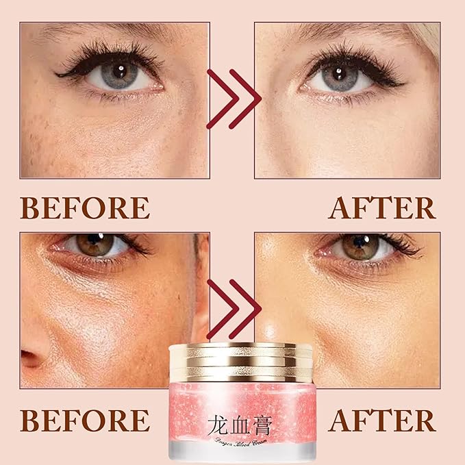 1PCS Dragons Blood Cream, Retinol Dragon Blood Cream, Royal Retinol Creams for Smooth Skin, Nourishing, Moisturizing, Firming Cream for All Skin Types