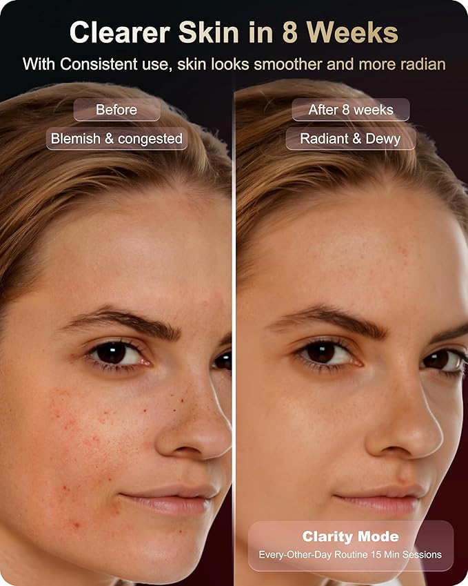 Lumefu Nimbus FDA-Cleared Light Therapy Mask, 3 Mode LED with Red, Near Infrared &Blue for Anti-Aging, Acne &Skin Rejuvenation, Roll to Pack OdorFree, Full face Comfort Fit, Cordless, USBC Recharge