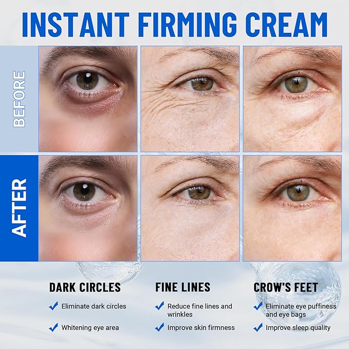 iMethod Perfection Eye Tightener - Temporary Eye Tightener Cream, Under Eye Cream Reduces Dark Circles & Puffiness, Instant Firming Formula for Fine Lines & Wrinkles, 20ml