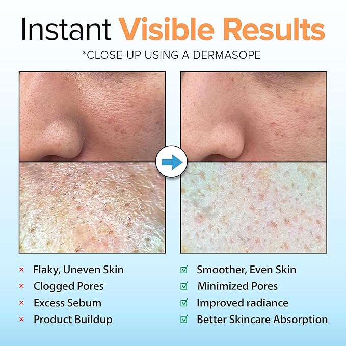 Ebanel 2-Pack Brightening Peeling Gel with Cotton Cellulose, Rice, Papaya, Centella, Hyaluronic Acid for Face and Body, Gentle Exfoliating Face Scrub Gel Peel Wash Pore Cleanser Minimizer Exfoliator
