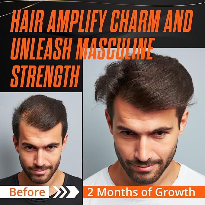 Abera Hair Growth Serum for Hair Loss, Natural Hair Regrowth Treatment for Hair & Beard with Biotin & Castor Oil | Extra Strength & Bigger Size 1.69 fl oz (1 Serum + Gift)