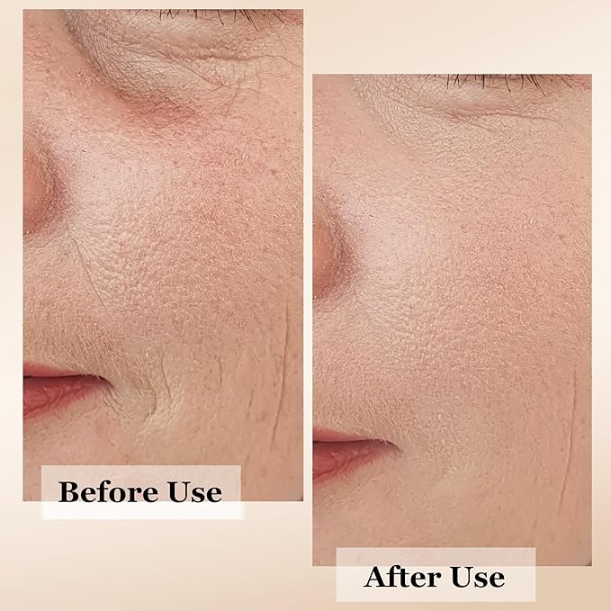 mivida Super Serum 4-in-1 Anti-Aging Face & Neck Serum | Retinol, Vitamin C, Hyaluronic Acid & RoseHip Oil | Reduces Fine Lines, Wrinkles & Dark Spots, Firms & Hydrates for a Youthful Glow – 1 Fl Oz