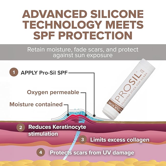 ProSil Silicone Scar Gel Stick with SPF 15 – Patented, Premium-Grade Scar Treatment in a Mess-Free, Compact, Glide-On Silicone Stick - Gentle Silicone Gel for Scars Suitable for Kids & Adults – 4.25g
