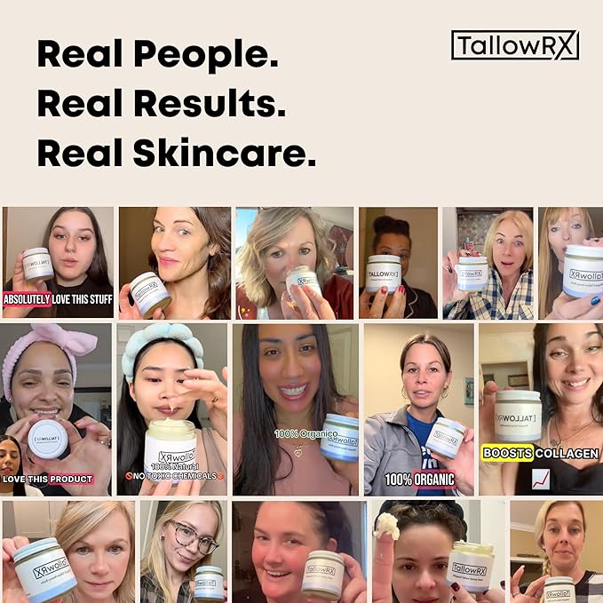 TALLOWRX Tallow Body Lotion – 100% Grass-Fed Beef Tallow for Skin, Face & Body – Pure & Organic Moisturizer with Jojoba Oil, Vitamin E (8 Fl Oz, Unscented)