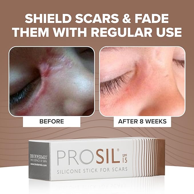 ProSil Silicone Scar Gel Stick with SPF 15 – Patented Scar Treatment in a Mess-Free, Compact Glide-On Stick - Made from Premium-Grade Silicone - Gentle on All Skin Types, Including Kids - 17g