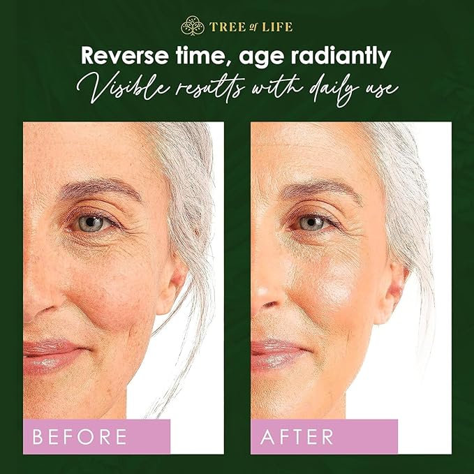 Tree of Life Beauty Retinol Serum, Skin Smoothing Face Oil for Dark Spots and Fine Lines, Facial Serums for Dry and Sensitive Skin Care with Hyaluronic Acid for Soft Smooth Skin, 2 Fl Oz (Pack of 3)
