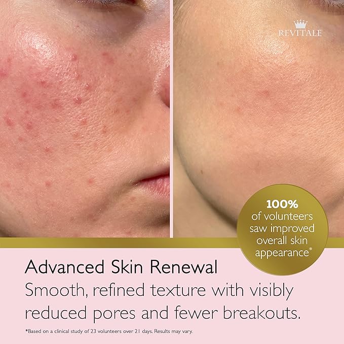 REVITALE Advanced Salicylic Acid Cream for Face & Body 80g – Helps Smooth & Soften Skin Texture. For Rough, Bumpy & Blemish-Prone Skin