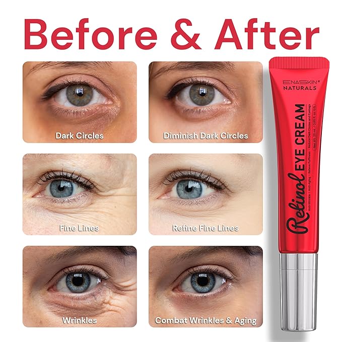 Retinol Anti Aging Eye Cream: Rapid Wrinkle Repair & Instant Under Eye Treatment - Reduce Dark Circles, Eye Bags, Puffiness for Women, Day & Night, 0.85 fl.oz