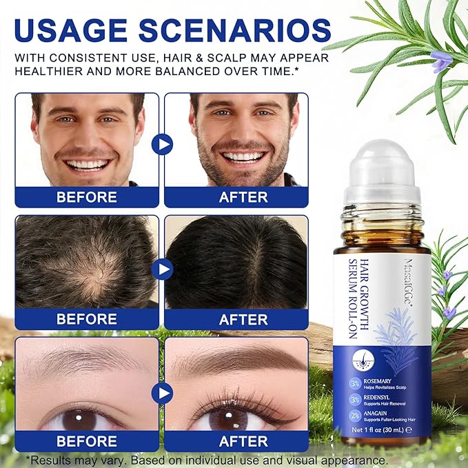 Hair Growth Serum Roll On, Hair Growth Serum Rosemary Oil Helps Hair Growth for Men and Women, Support Scalp Health, Fast-Absorbing, Non-Greasy (30ml)