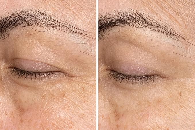 Eye Cream -1pcs