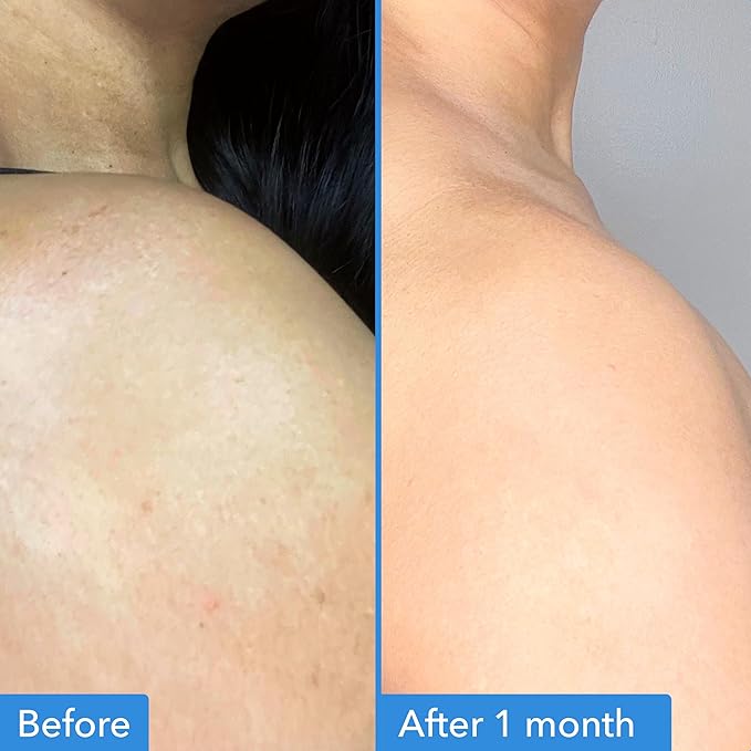 Good Molecules Discoloration Correcting Body Treatment - Anti-Pigment Cream with Niacinamide, Tranexamic Acid - Target Dark Spots and Moisturize - Skincare for Body