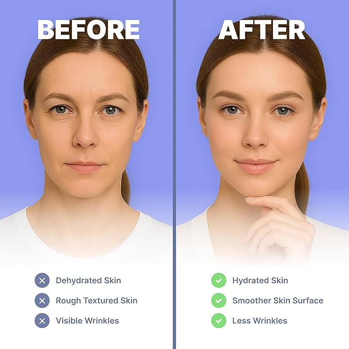 Crows Feet & Anti Aging Forehead Wrinkle Patches with Retinol, Niacinamide & Collagen | Anti Wrinkle Face Tape for Eleven Lines, Smile Lines & Eye Wrinkles | Overnight Wrinkle Patches for Women & Men