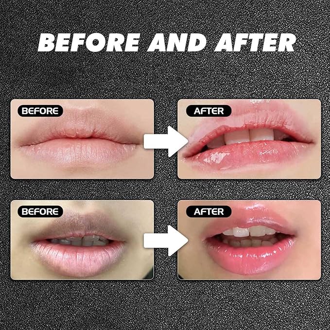 Lip Lightening Lip Balm for Dark Lips – Lip Softening & Hydration,Help Fade Dark Lip Discoloration, Moisturizing Lip Balm for Smokers,Reduces Discoloration & Fine Lines,for Men And Women
