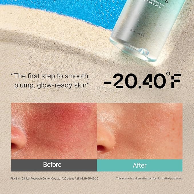 Overlaps 5000ppm Ectoin Calming Toner | Redness Relief & Barrier Repair for Sensitive & Blemish-Prone Skin | Glass Skin Hydration with Hyaluronic Acid & Panthenol | Korean Skincare, 8.45 fl. oz.