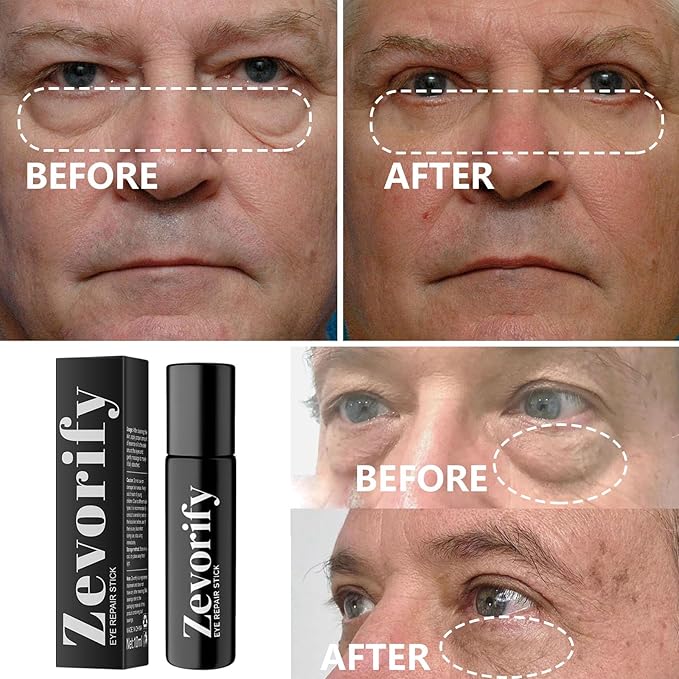 Eye Repair Stick for Men | Caffeine Under Eye Roller for Eyebags and Dark Circles - Cooling Stick Hydrates and Depuffing, 0.34 Fl Oz (1 PC, 0.34 Fl Oz/PC)