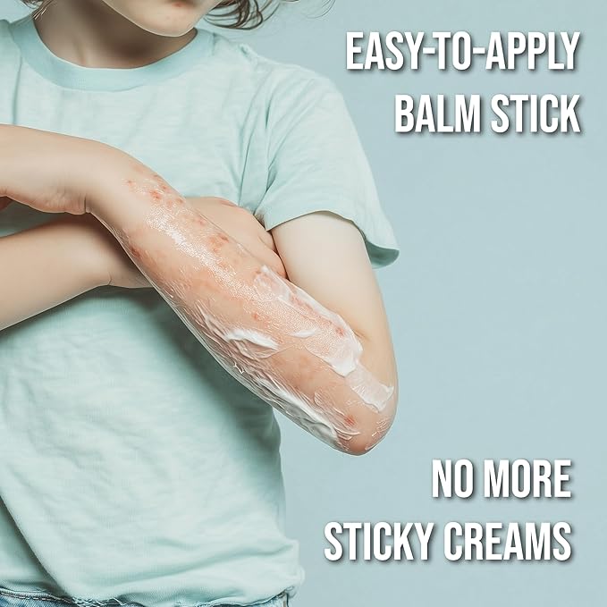 quitch Hydrocortisone Healing Balm, Eczema Cream for Kids Stick, Psoriasis Relief Treatment, Anti Itch Maximum Strength, Healing Ointment, Rash, Dry Skin Treatment for Skin, Avocado Oil Squalane