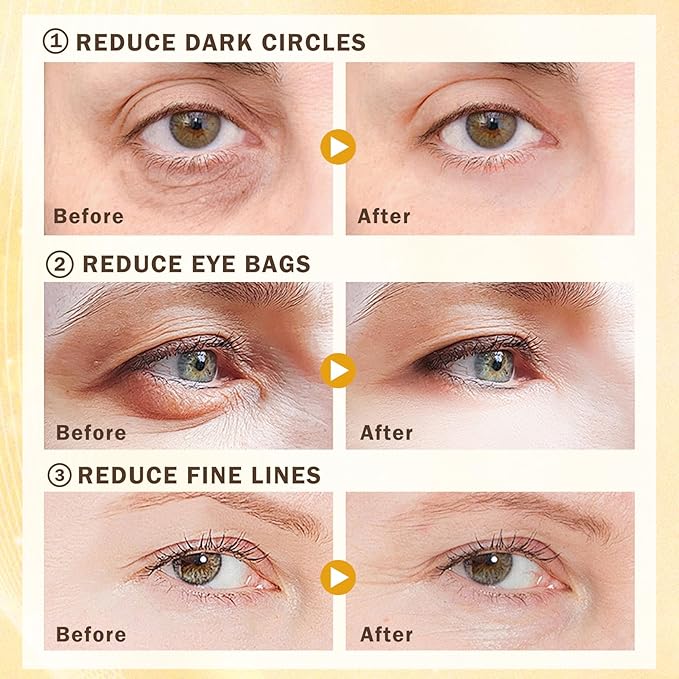 CAHIUYOA 30 Pairs Gold Eye Mask Under Eye Patches for Dark Circles and Puffy Eyes Moisturizing Under Eye Mask Reduce Eye Bags