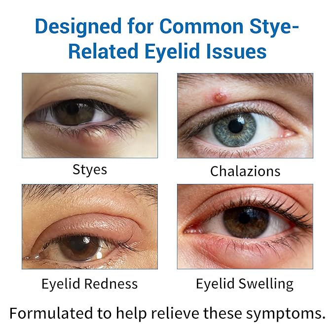 Stye Eye Treatment Kit, Relief for Styes, Chalazions, Blepharitis, Dry Eyes, Irritation and Swelling; Clear Eyes Redness Relief, Stye Eye Compress, Eye Patches, Eye Mask, Eye Stye Treatment