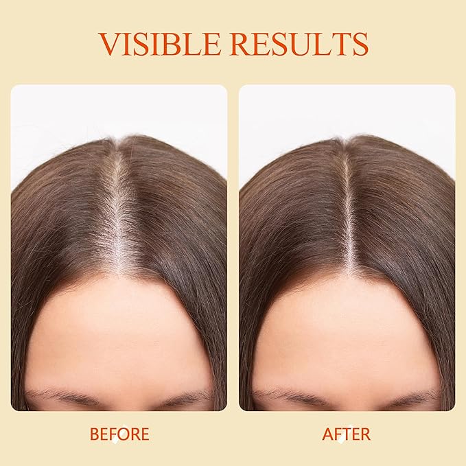 Hair Growth Oil Spray for Women: Natural Hair Growth Serum Women with Rosemary, Batana Oil & Biotin, Promotes Thicker, Fuller & Healthier Looks