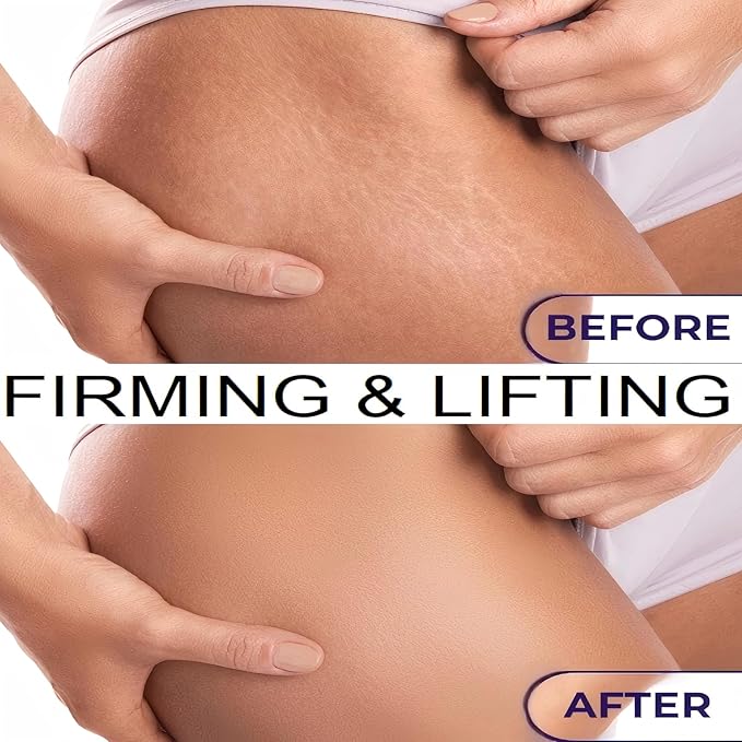 Body Firming Oil – 4.06 FL OZ | Tightening & Hydrating Treatment | After Shower Body Oil For Women | Natural Body Luxury Oil for Dry Skin | Lightweight, Non-Greasy, Nourishing Formula