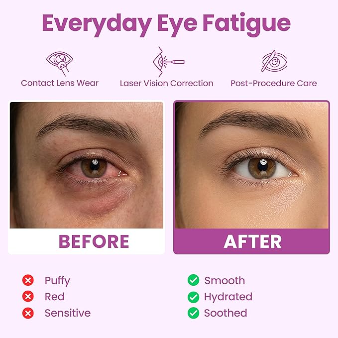 Eye Serenity Steam Eye Mask, Heated Eye Mask, Self Heating Warm Compress for Dry Eyes, Fast Relief for Stye, Puffy Sensitive Eyes, Moist Heat, Mothers Day Gifts for Women and Men - Variety