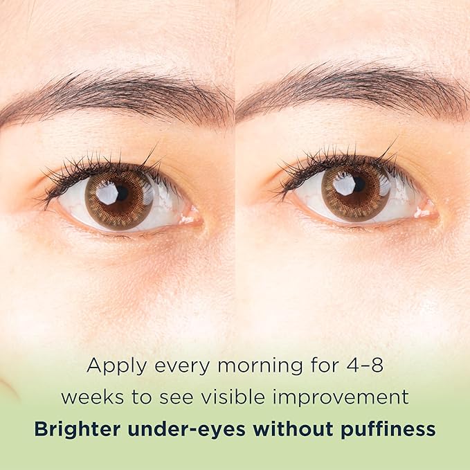 MATKAS Korean Vitamin C Under Eye Cream for Dark Circles and Puffiness 0.5 Fl. Oz. - Brightening Under Eye Cream with Caffeine for Puffy Eyes, Korean Under Eyes Brightener Moisturizer, Caffeine Serum