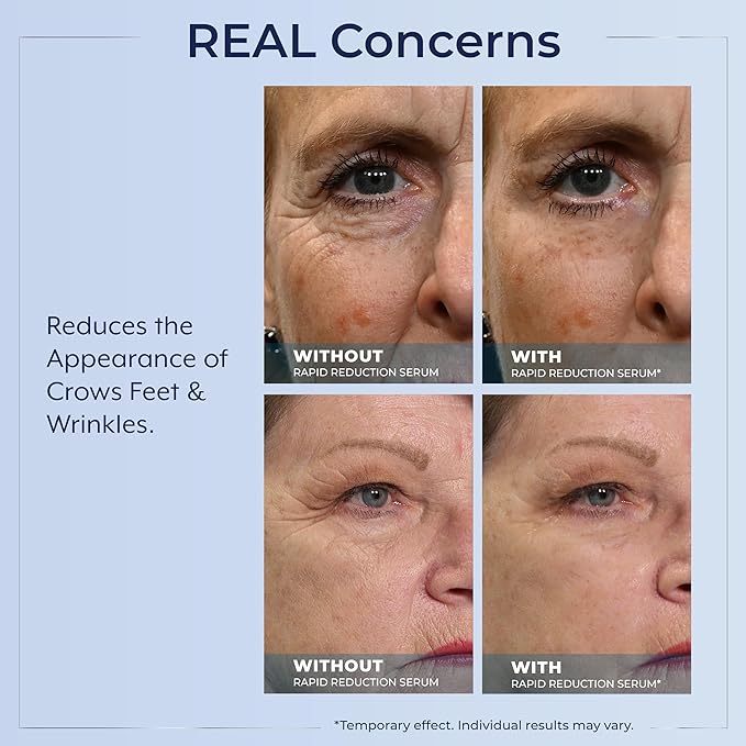 Plexaderm Rapid Reduction Eye Serum - Visibly Reduces Under-Eye Bags, Wrinkles, Dark Circles, Fine Lines & Crow's Feet Instantly, Anti Aging Wrinkle Remover for Face, 30 Single Use Pods