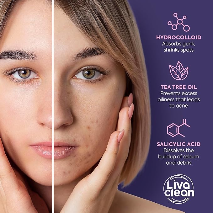 Livaclean Star Pimple Patches for Face w/ Hydrocolloid, Tea Tree oil & Salicylic Acid - Zit Stickers, Hydrocolloid Acne Patches for Face - Cute Pimple Patch, Acne Stickers | w/Hydrocolloid, Salicylic Acid, Tea Tree, Healing Stickers, Zit Superstar