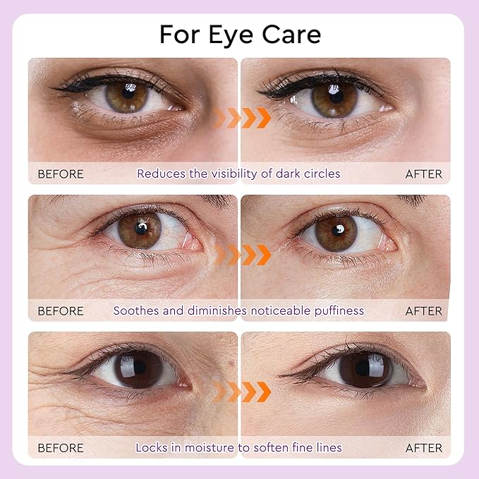 Under Eye Patches - 30 Pairs Retinol Eye Mask Patches for Dark Circles, Puffy Eyes, Wrinkles - Mothers Day Birthday Gifts for Women - Gel Eye Patches Skin Care Spa Gifts for Woman