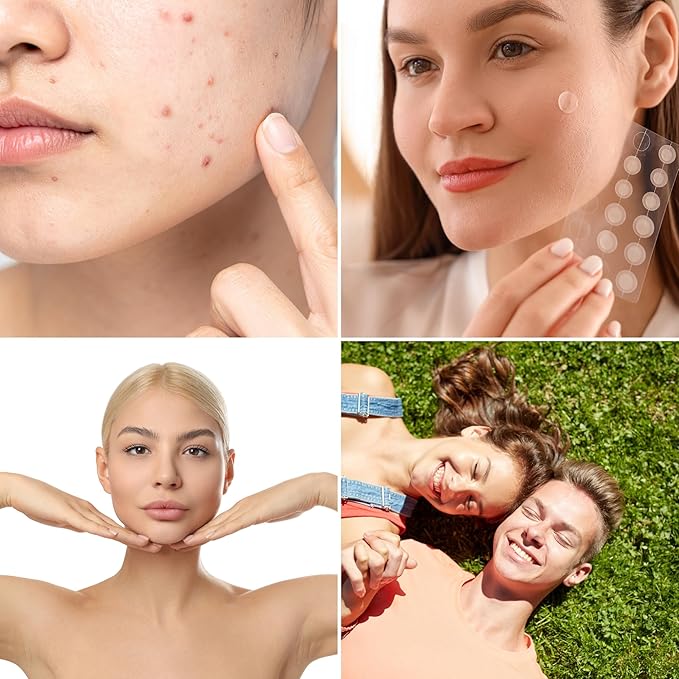 12HR Rescue Pimple Patch Variety Pack - Hydrocolloid Acne Spot Treatment - Invisible Dots for Overnight Blemish Care, 108 count