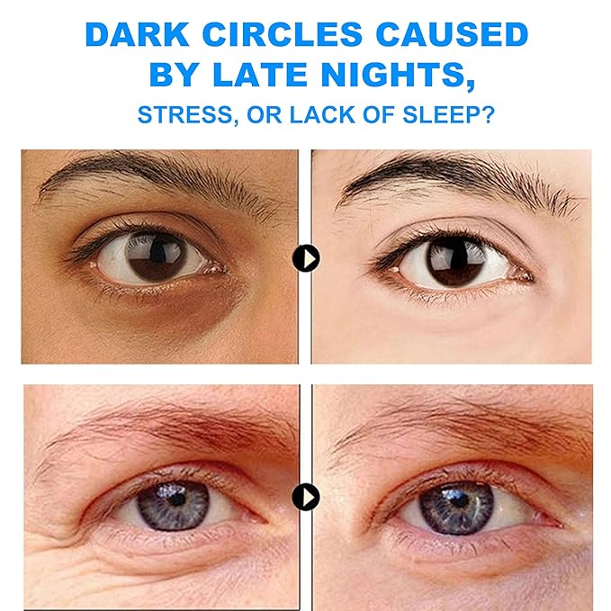 Moisturizing Men's Eye Repair Cream with Aloe & Protein Peptides, Hydrating Under Eye Cream to Reduce Puffiness, Dark Circles, Crows Feet and Bags, Daily Skin Care Treatment Cream, 1.69 oz