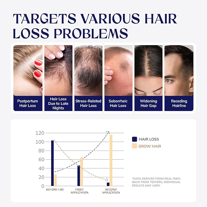 Hair Growth Serum, Rice Water & Biotin & Caffeine, Hair Growth Spray for Men & Women, Hair Oils for Hair Growth - Hair Thinning, Longer, Fuller Hair, Enriched with Seven Herbal Extracts