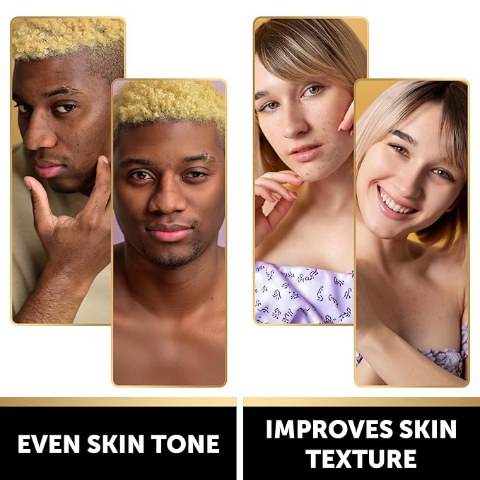 VALITIC Kojic Acid Soap - Turmeric Soap for Dark Spots for Face and Body - Exfoliating Bar for Hyperpigmentation, Skin Tone Corrector with Retinol, Vitamin C, Collagen and Hyaluronic Acid - 2 Pack