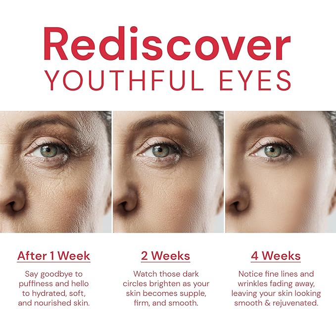 Retinol Anti Aging Eye Cream: Rapid Wrinkle Repair & Instant Under Eye Treatment - Reduce Dark Circles, Eye Bags, Puffiness for Women, Day & Night, 0.85 fl.oz