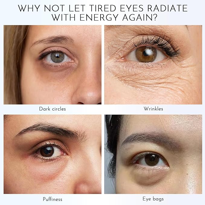 Caffeine Eye Cream - Eye Cream with Caffeine & Niacinamide for Dark Circles and Puffiness, Under Eye Treatment Reduces Puffy Bag & Fine Line, Hydrating & Brightening Eye Area Skin Care for Women & Man