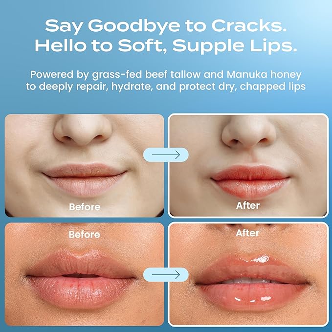 Body Restore Grass Fed Beef Tallow Lip Mask, Manuka Honey – Christmas Stocking Stuffers, White Elephant, Hydrating Moisture, Travel Essentials, Self Care, Birthday Gifts for Women, Men – Peppermint